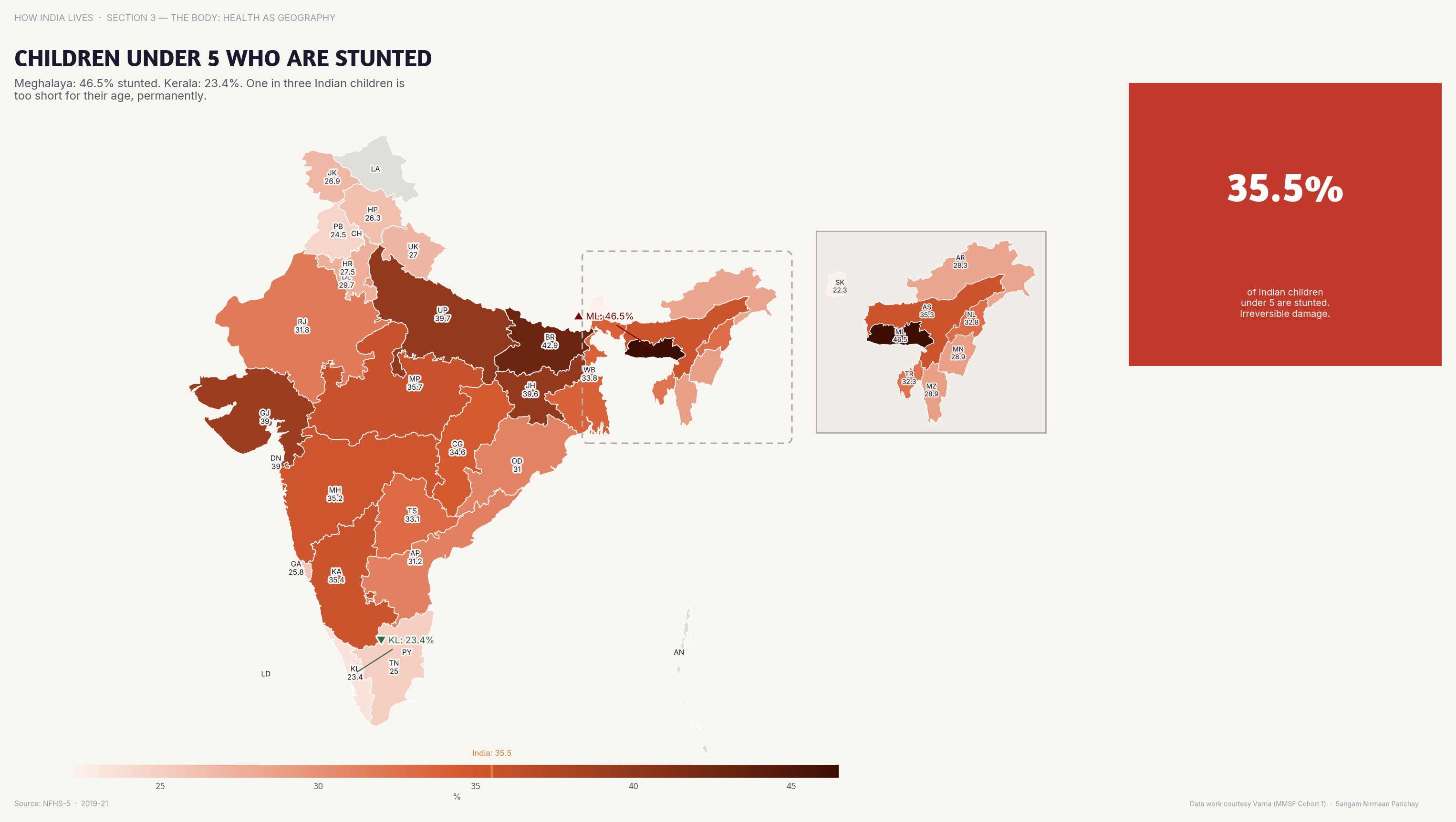 Choropleth map of India by state: Children Under 5 Who Are Stunted. 38% of under-5 children in Bihar are stunted; in Kerala it's 12% — being born in the wrong state costs you inches.